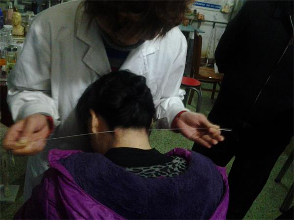 濟(jì)寧哪里可以學(xué)針灸技術(shù)？